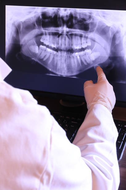 Best Emergency Tooth Extraction in Neoga, IL