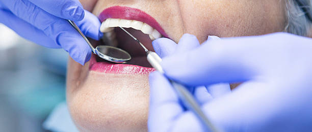 Best Emergency Dental Care for Broken or Chipped Teeth in Neoga, IL